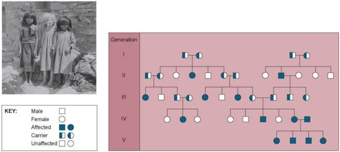 Pedigree worksheet 3 hemophilia the royal disease answer key